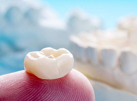 dental crowns dentist near me same day crowns